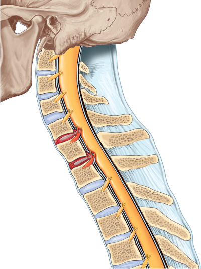 pain in cervical spine